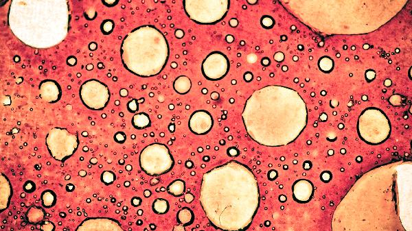 简述细菌性痢疾的传播途径