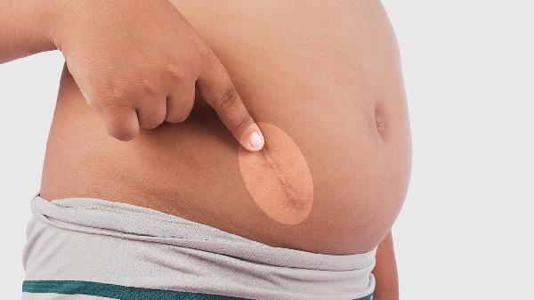 怎么判断腹部肌肉拉伤还是乳酸堆积