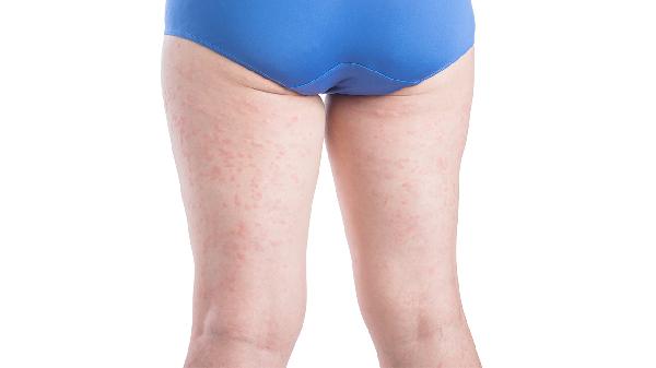 大腿粗怎么办 教你立减粗大腿的6方法