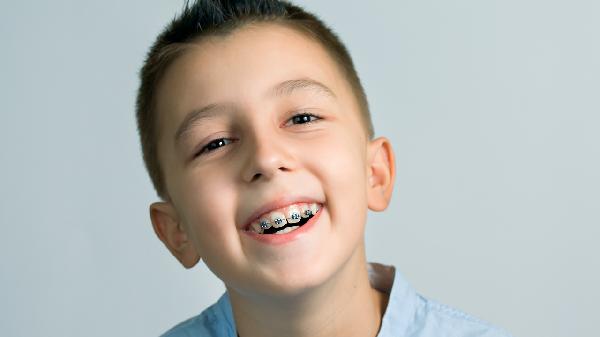 孩子整牙戴钢丝牙套好还是隐形牙套好