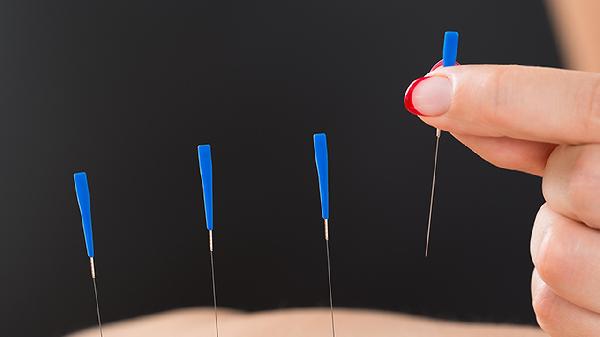 急性腰扭伤针灸快速见效