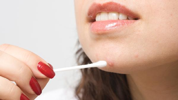 40岁的女人下巴老是长痘痘是怎么回事