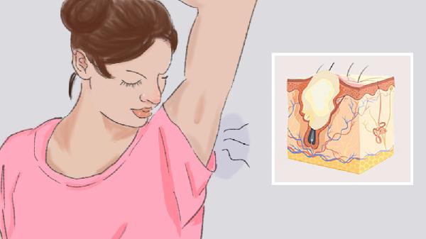 女性腋臭什么年龄消失