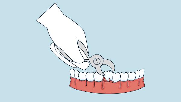 空腹血糖10点多可以拔牙吗