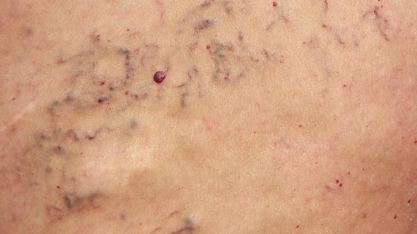 锻炼膝盖最好的方法