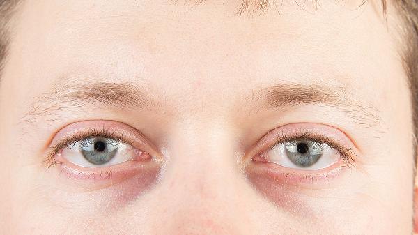 风一吹就流眼泪是什么原因