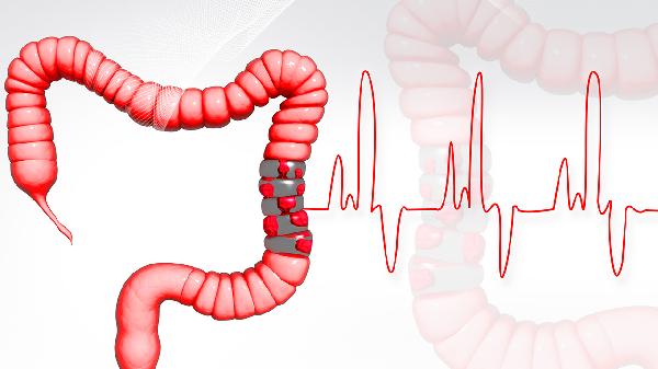 结肠癌来临时,会发出4种异常信号!4类人需检查肠镜,不能拖