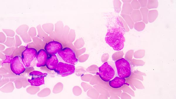 hpv16感染多久会癌变