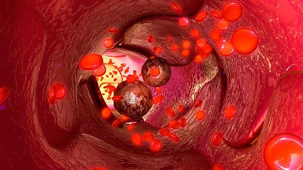 大人感染诺如病毒需要怎么补水