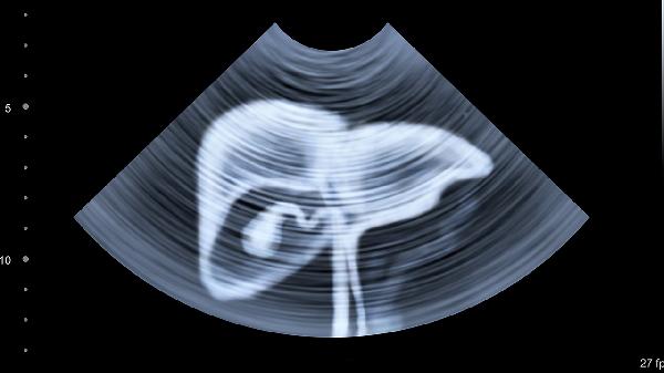 B超憋尿与不憋尿检查有什么区别