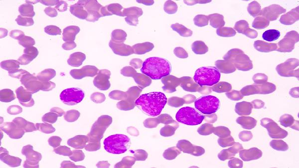 甲肝病毒或可“威胁”肝脏，日常预防措施中，注意饮食卫生很重要