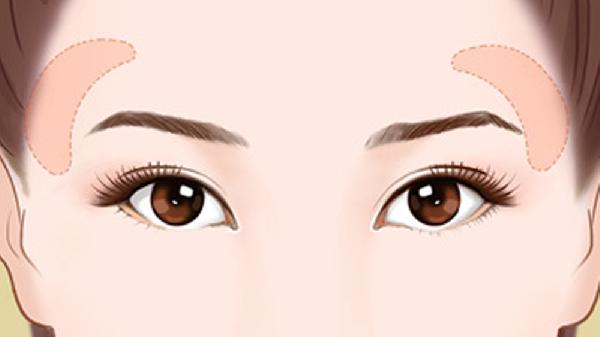 太阳穴长痘去除方法有几种