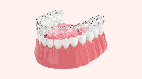 适合矫正牙齿的年龄揭秘 这两个是牙齿矫正的黄金时间