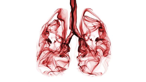 腮腺恶性肿瘤能治好吗 3个方法联合控制腮腺癌