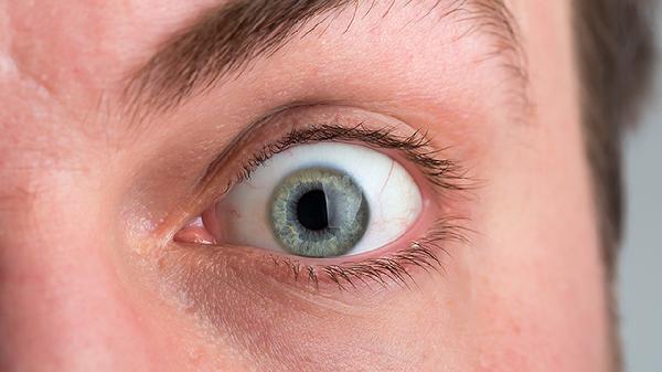 眼眶凹陷怎么治疗 眼眶凹陷的3个疗法剖析
