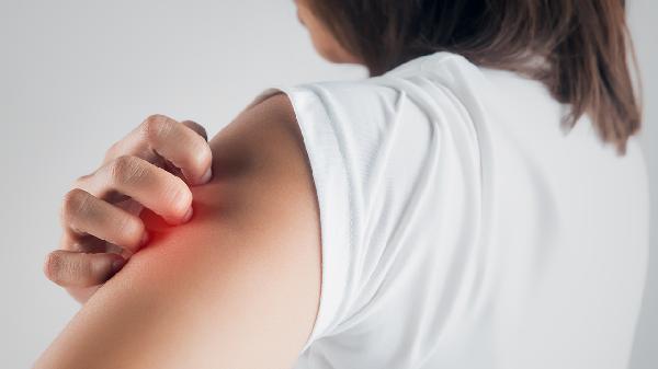 皮肤过敏期间吃什么好 皮肤过敏饮食注意6大点