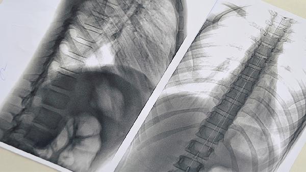 为什么诊断非要依据静脉血糖