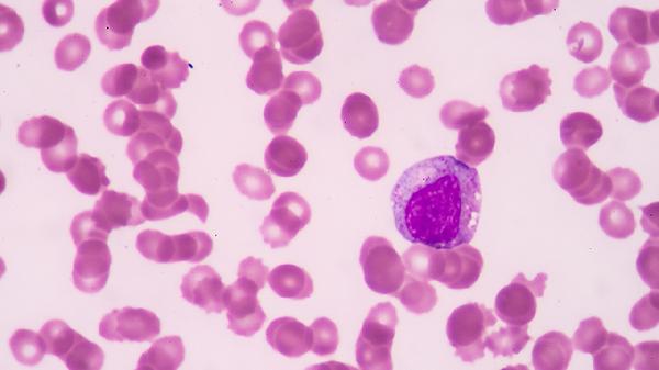 血小板高中性粒细胞高是怎么回事