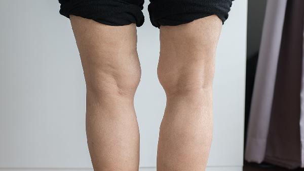 眼肌麻痹吃什么好 了解眼肌痉挛的饮食禁忌