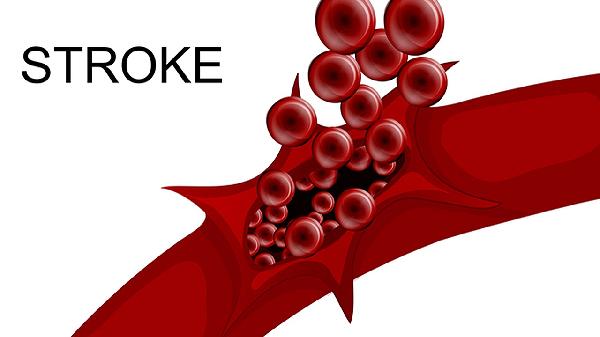 眼血管堵塞是什么原因造成的