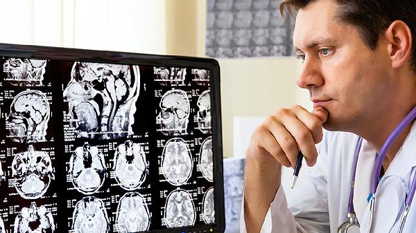 脑部搭桥手术怎么做 脑部搭桥手术具体步骤介绍