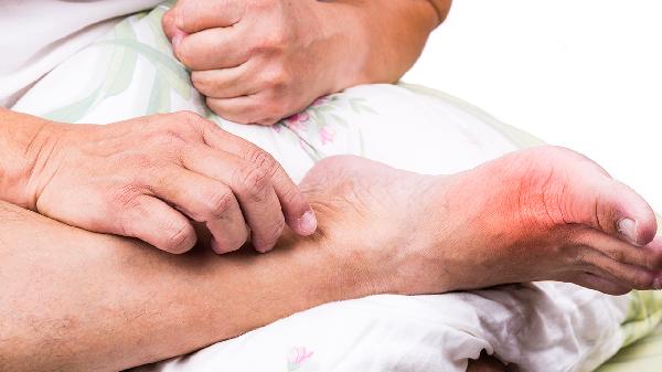 腳跟生骨刺怎么治療 腳跟生骨刺的3個療法分享