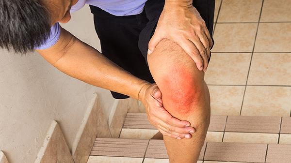 肋软骨膜炎严重吗 4个症状说明肋软骨膜炎很严重