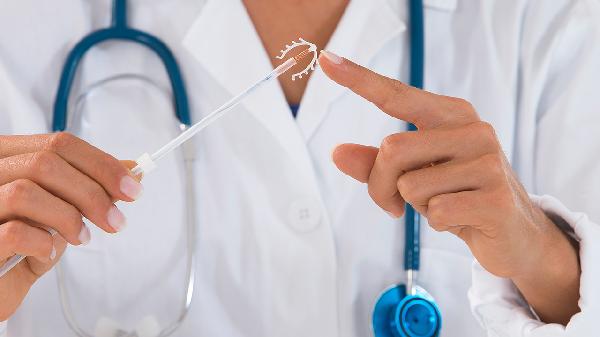 节育环变形了会引起哪里不适