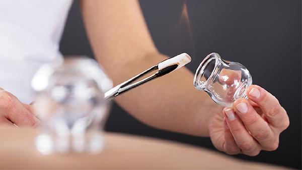 拔火罐时，后背吸出来的瘀血，是身体内的毒素吗？