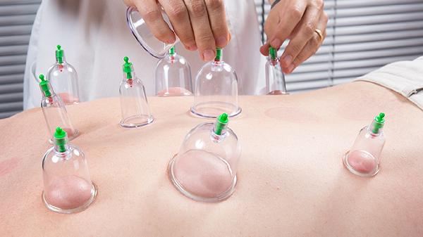 拔火罐时，后背吸出来的瘀血，是身体内的毒素吗？