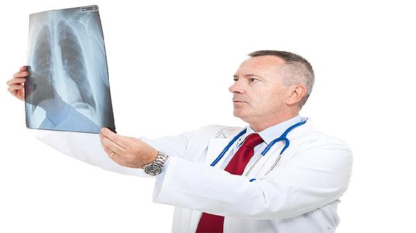 肺曲霉菌病會(huì)轉(zhuǎn)化為肺癌么