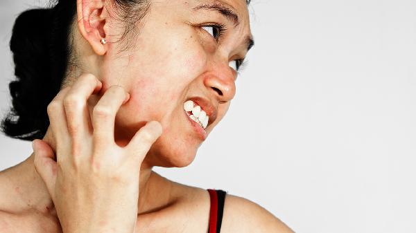 光子嫩肤可以去斑吗