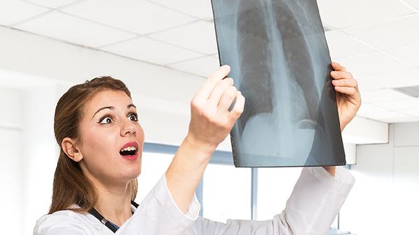 润肺止嗽丸有什么注意事项