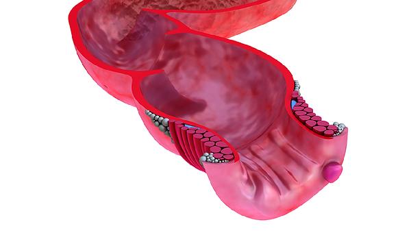 重组牛碱性成纤维细胞生长因子凝胶怎么用