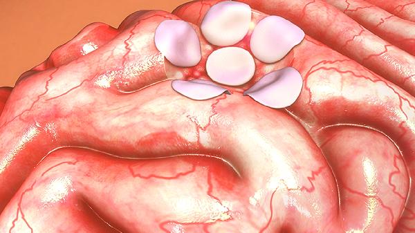 氨糖美辛肠溶片有什么需要注意的