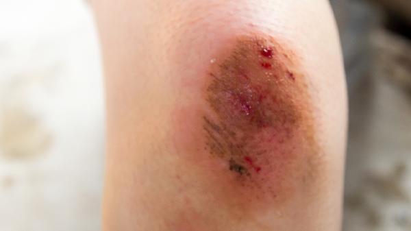 租房子洗衣机怎么消毒清洗