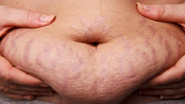 怎么皮肤变得白嫩光滑