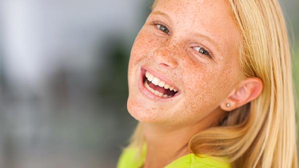 雀斑淡化最有效的方法