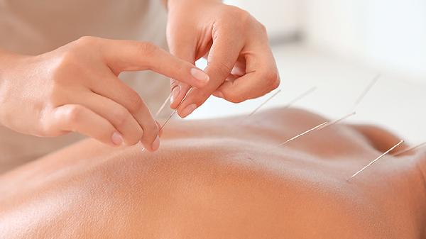 针灸怎么样才算扎到位