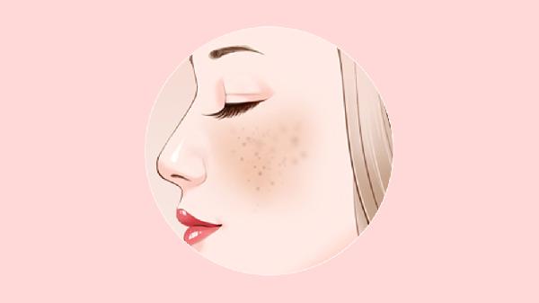 女人祛斑的重要性