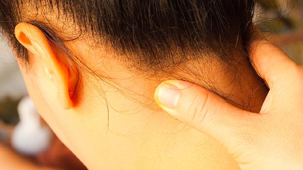 每个人都有颈纹吗