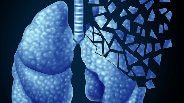 熟牛肝腥味太重怎么办