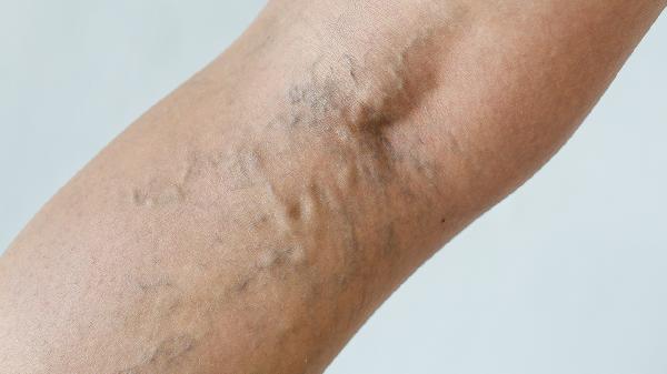 手臂粗的皮皮虾叫什么