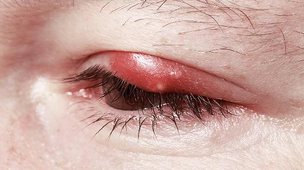 舟山带鱼眼睛是白的还是黄的