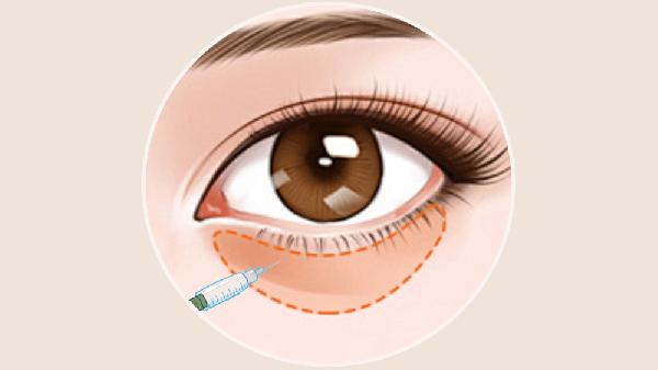 adm卧蚕可以维持多久