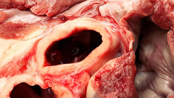 猪肉油腻的解决方法