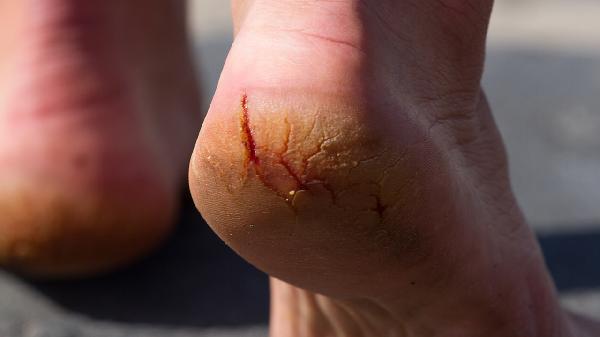 足够的蛋白质有利于减脂吗