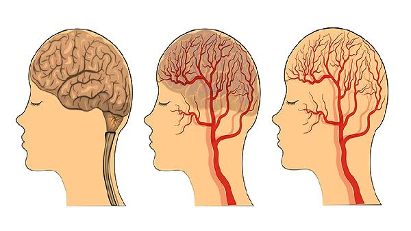 大脑前额叶发育不良怎么检查