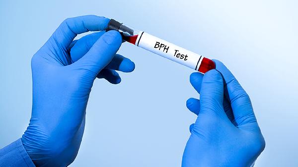 男性体检查出前列腺钙化怎么办？有哪些应对方法？