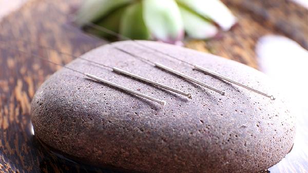 偏瘫可以针灸吗 详述偏瘫的针灸疗法